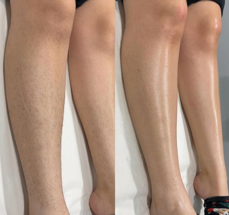 Gentle Flavored Waxing (Arms, Legs, Underarms & Face)